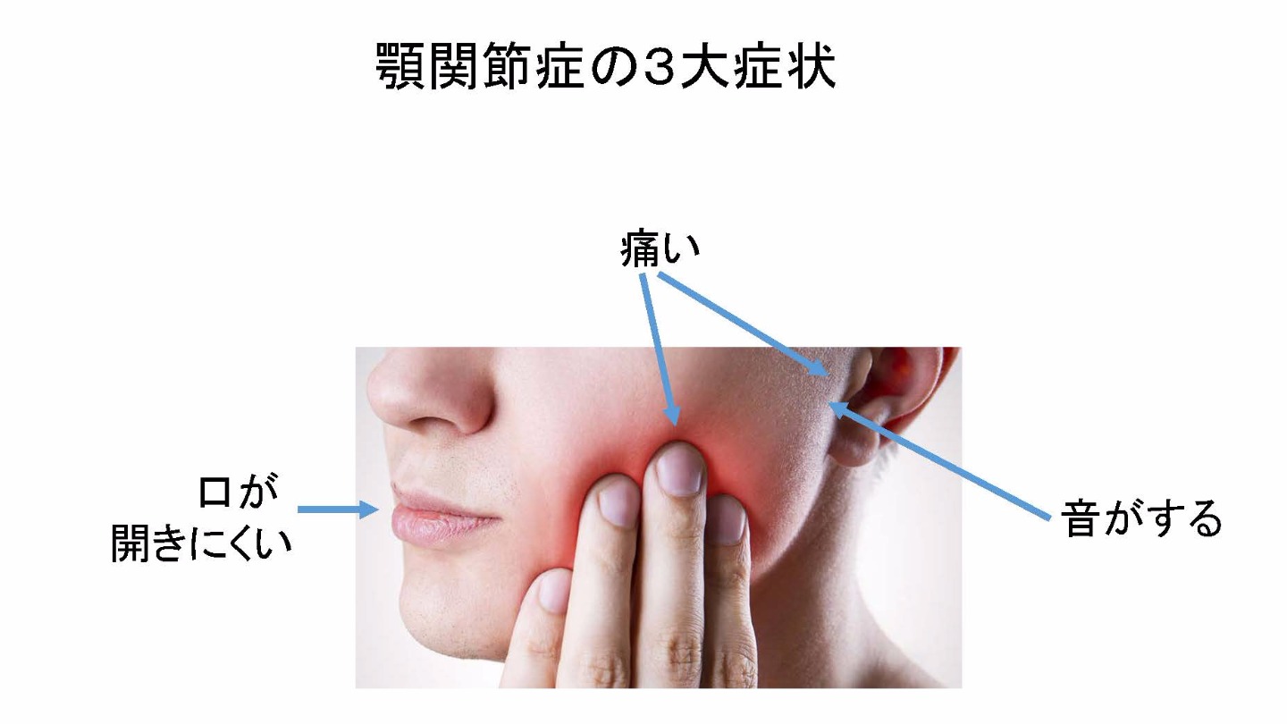 額 関節 痛 症 治療 法