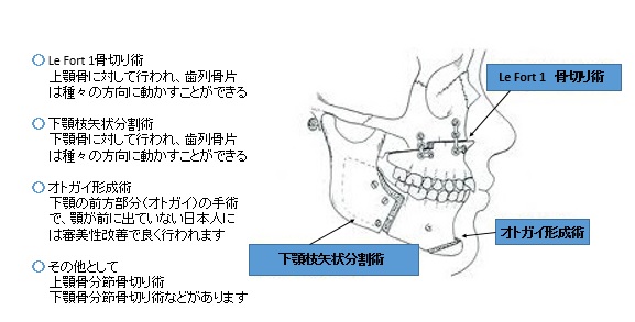 出す 顎 意味 を