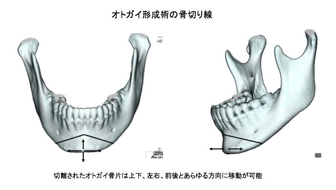 オトガイ 形成 と は